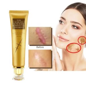 crème anti cicatrices – répare et lisse la peau